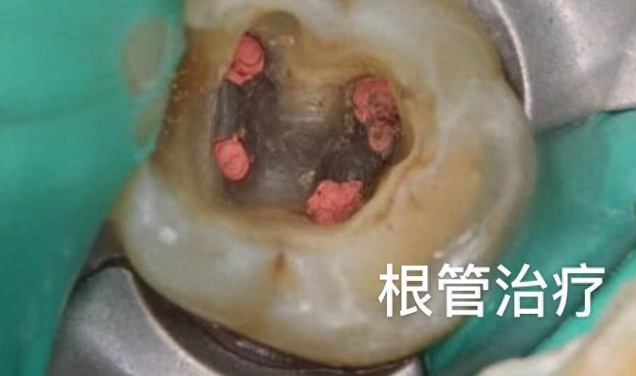 天津青苗口腔看牙靠譜嗎？專(zhuān)家團(tuán)隊(duì)實(shí)力解讀及地址分享