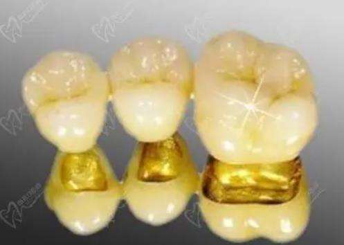 北大口腔醫(yī)院種牙掛什么科室？哪位醫(yī)生技術(shù)好？費用一覽