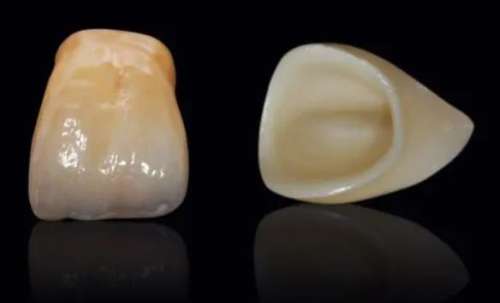 上海凸嘴整形手術(shù)：醫(yī)生技術(shù)、價格分析及手術(shù)前必備資料