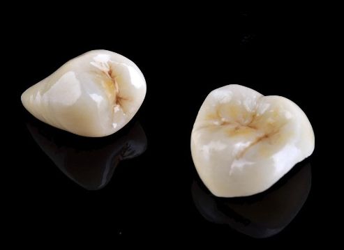 深圳牙齒矯正價(jià)目表一覽：專家點(diǎn)評(píng)，實(shí)力測(cè)評(píng)
