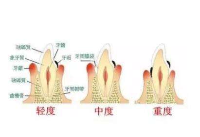 南京口腔診所排行榜前三，專家推薦！