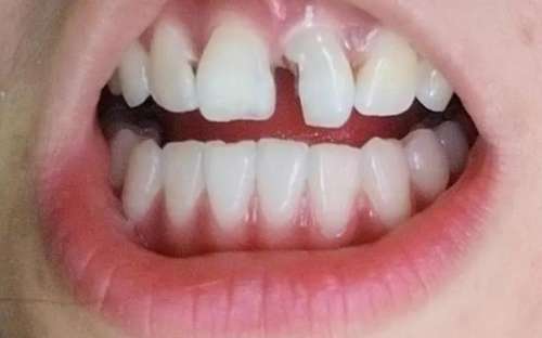 南京口腔醫(yī)院掛號(hào)預(yù)約攻略【口腔醫(yī)生、地址、收費(fèi)價(jià)格表】