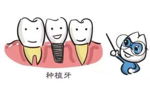 權(quán)威指南：上海九院種植牙專(zhuān)家實(shí)力大揭秘！