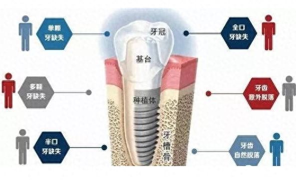 長沙口腔醫(yī)院哪個院區(qū)好？——分院概覽、專家陣容、種植牙價格全解