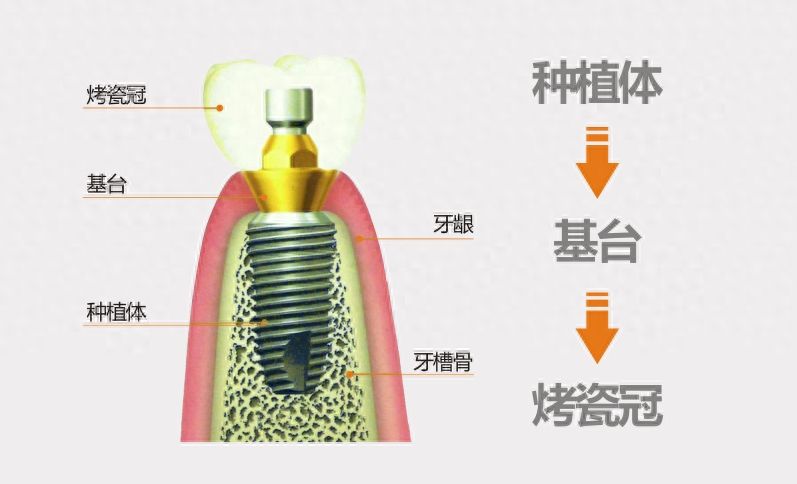 蘇州牙科醫(yī)院哪家強(qiáng)？專家推薦5家實(shí)力派
