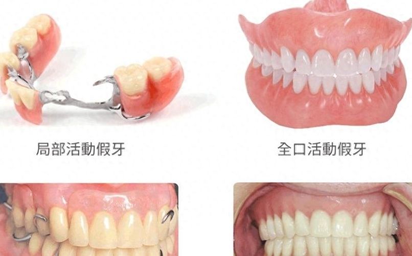 上海九院牙齒矯正達(dá)人親薦！這幾位醫(yī)生口碑強(qiáng)