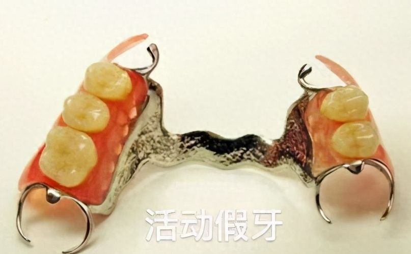 重慶牙科種植醫(yī)院排行榜：專家推薦，性價比高！