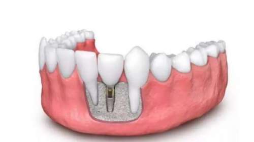 http://www.chicagonutritionsolutions.com/d/file/rank/dnnt88va1n.jpg