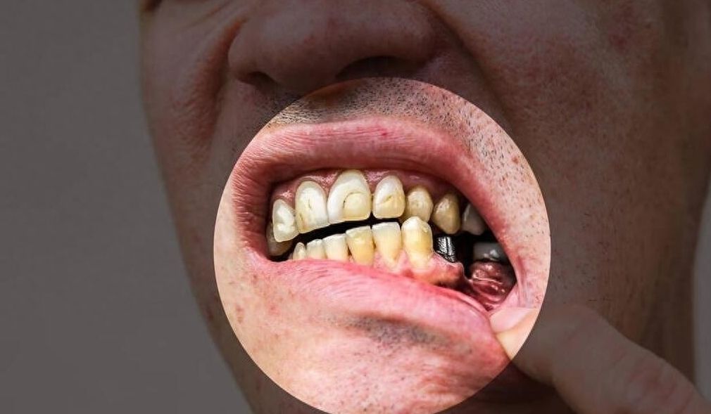 天津口腔醫(yī)院正畸科醫(yī)生及收費標準一覽