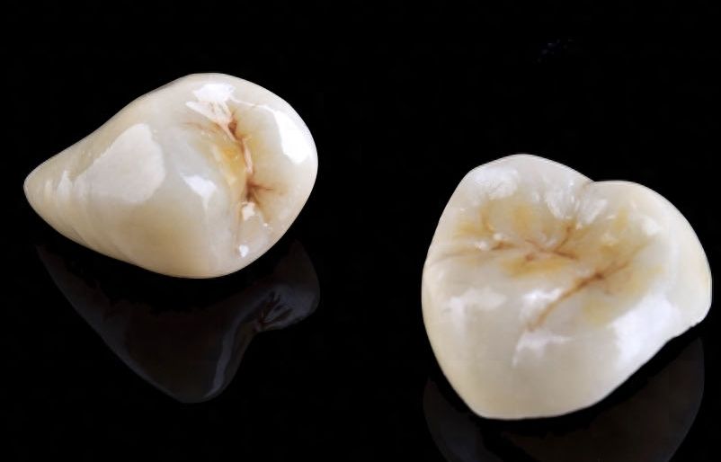 深圳誠致美口腔：專業(yè)醫(yī)生陣容，硬核技術(shù)解碼