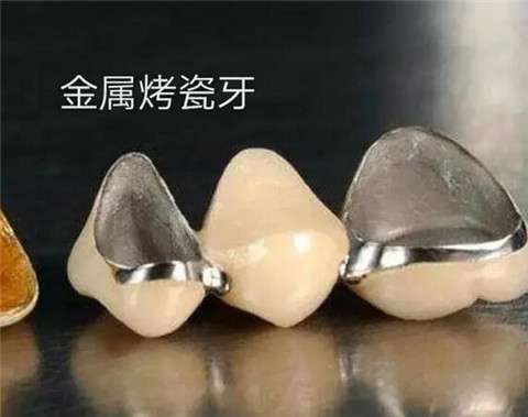 長(zhǎng)海醫(yī)院口腔種植科：徐曉剛、唐震專家團(tuán)隊(duì)介紹及價(jià)格表