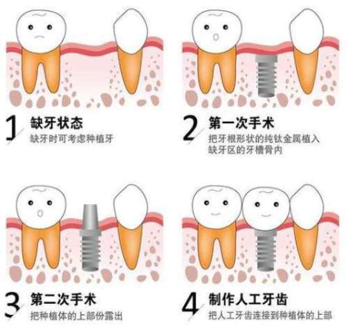 濰坊口腔醫(yī)院專(zhuān)家排行榜前五揭曉