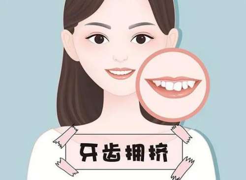 北京瑞冠口腔門(mén)診部醫(yī)生特長(zhǎng)介紹及正畸價(jià)格匯總
