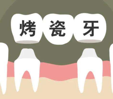 深圳市人民醫(yī)院口腔科口碑如何？推薦醫(yī)生及放號(hào)時(shí)間