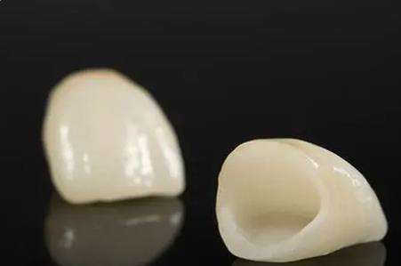 成都哪家牙科矯正技術(shù)強？瑞安口腔專家實力、案例了解