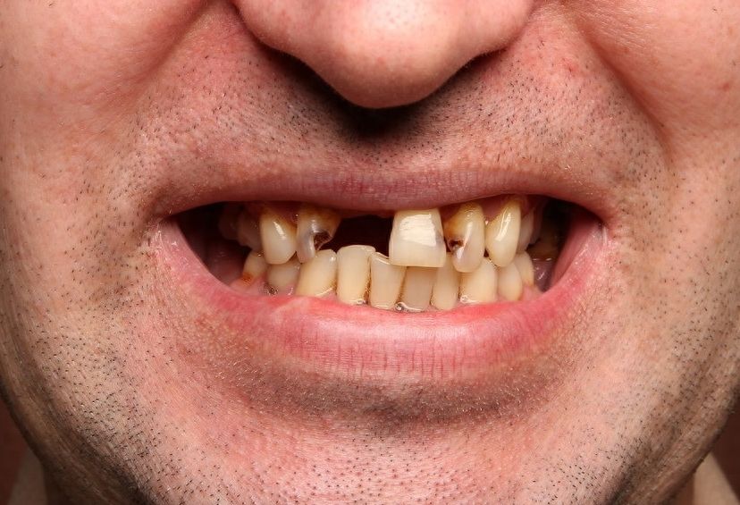 中山二院口腔科：醫(yī)生介紹、科室信息、矯正案例詳解