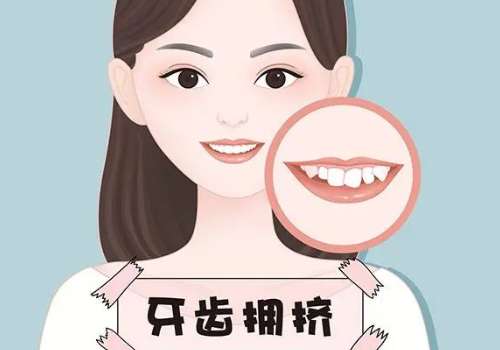 沈陽牙齒矯正哪家好？唯愛口腔蔣曉輝醫(yī)生真實案例分享！