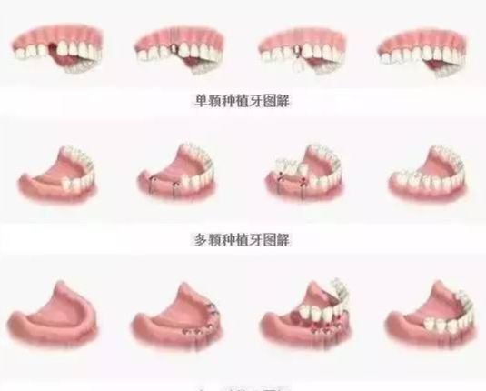 上海尤旦口腔口碑好不好？醫(yī)院地址、醫(yī)生和收費(fèi)參考