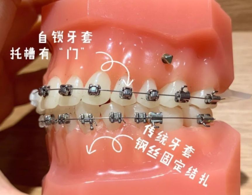 深度揭秘：華西口腔醫(yī)院就診指南（含預(yù)約、醫(yī)生推薦及費(fèi)用）