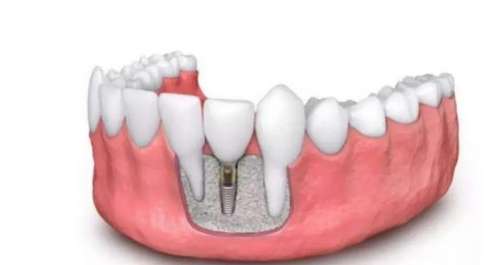 http://www.chicagonutritionsolutions.com/d/file/rank/magnnoom0fve.jpg