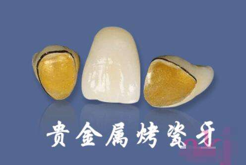 西安畫美團(tuán)圓口腔矯正：專家坐診，值得信賴