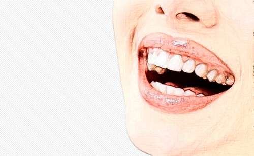 福州維樂口腔網(wǎng)上預(yù)約掛號：陳獻(xiàn)禮、郭淑蘋醫(yī)生預(yù)約方式解析