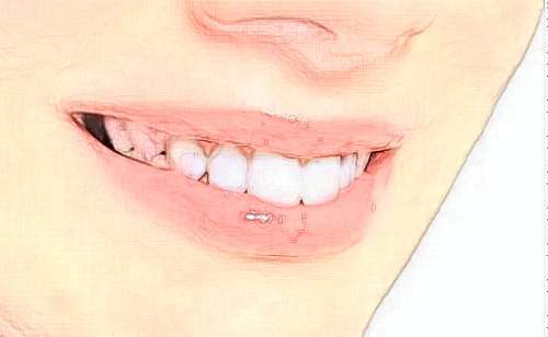 合肥第二人民醫(yī)院口腔科：特色項目、醫(yī)生團隊、收費介紹