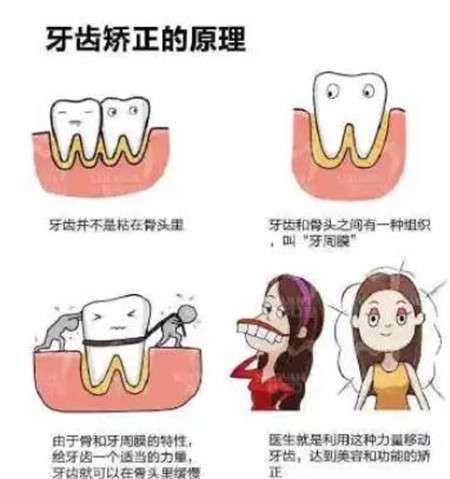 深圳寶安區(qū)牙科醫(yī)院推薦：附醫(yī)生介紹、矯正價(jià)格及真實(shí)案例分享