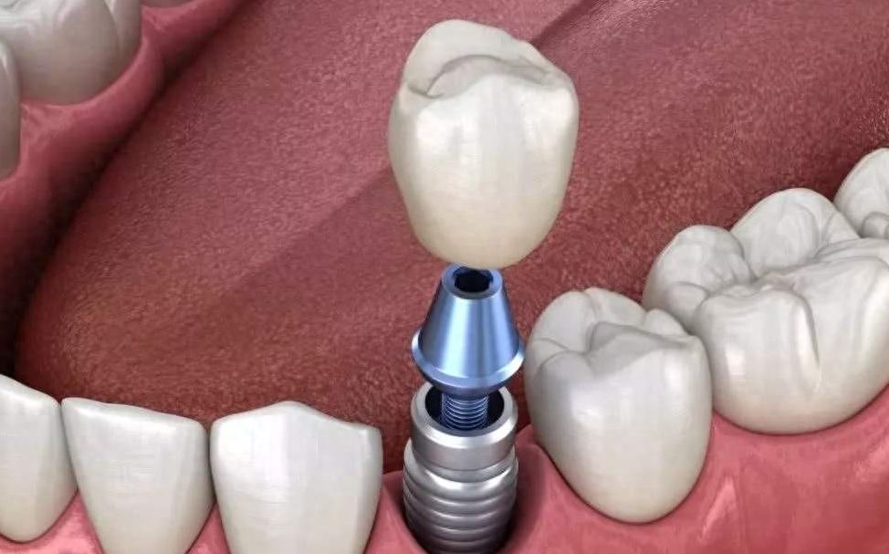 http://www.chicagonutritionsolutions.com/d/file/rank/pgves239bi.jpg