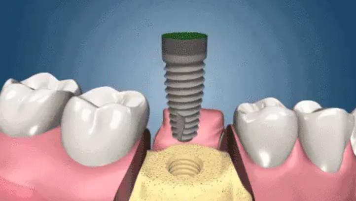 http://www.chicagonutritionsolutions.com/d/file/rank/pn0zohcoqfc5.jpg