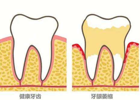 昆明雅度口腔口碑怎么樣？附醫(yī)生介紹+收費標準+種植牙實例
