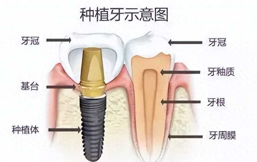 景德鎮(zhèn)口碑好的牙科醫(yī)院：正畸醫(yī)生推薦、成功案例展示