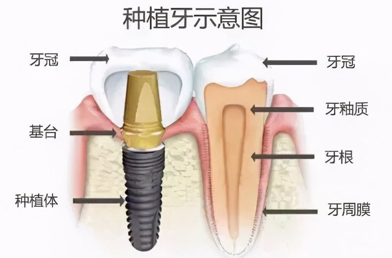 德州美和口腔門診部靠譜嗎？深度解析：醫(yī)生團(tuán)隊(duì)、特色服務(wù)及收費(fèi)標(biāo)準(zhǔn)