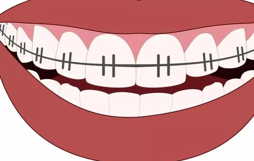 合肥長(zhǎng)庚口腔科好不好？揭秘醫(yī)生團(tuán)隊(duì)與精彩案例