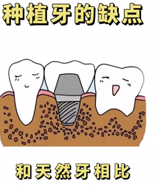 揭秘銀川諾貝爾種植牙：醫(yī)生水平、技術(shù)工藝、費(fèi)用全解析