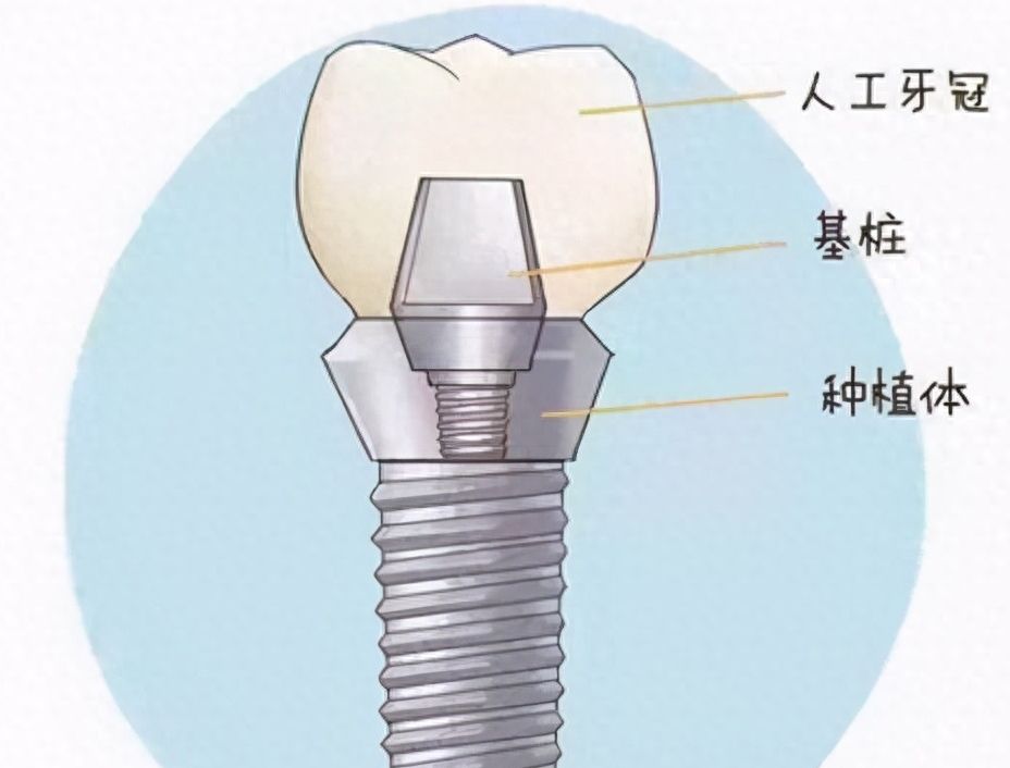 大連潔雅口腔醫(yī)院張健醫(yī)生治療效果如何？