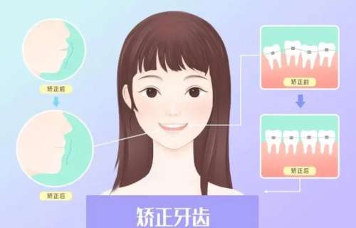 鄭州植牙醫(yī)院正規(guī)嗎？種植牙效果如何？附劉明舟、原輝婷醫(yī)生介紹