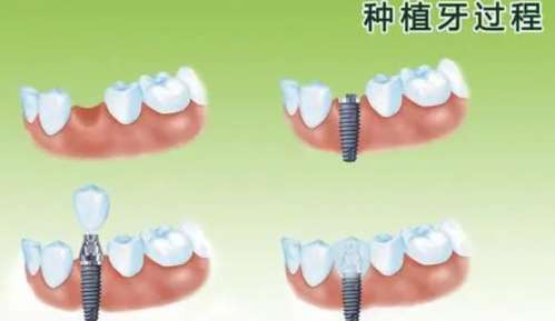 宿州市哪個(gè)牙科醫(yī)生口碑好？