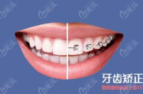 廣東五大口腔醫(yī)院排名榜單揭曉，牙科專家TOP5實(shí)力推薦！