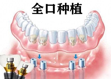 美亞口腔診所：專(zhuān)家診療，打造自信笑容