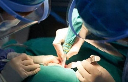 南京美奧口腔牙齒矯正攻略：朱峰、陳玉潔醫(yī)生技術(shù)解析